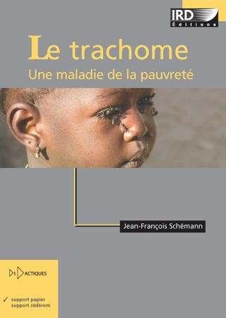 Jean-François Schémann Le trachome Une maladie de la pauvreté IRD Éditions 14. Le traitement chirurgical du trichiasis DOI : 10.4000/books.irdeditions.