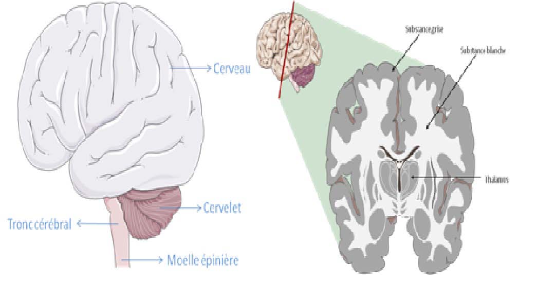 Atteinte du cerveau et des nerfs Certaines zones du système nerveux subissent une dégradation (dégénérescence).