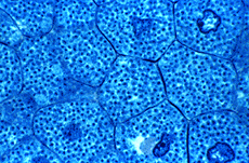 Les bactéries des nodules de légumineuses Les plantes de la famille des légumineuses vivent en association étroite avec des bactéries fixatrices d'azote appartenant au genre Rhizobium.