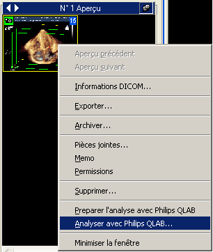 En sélectionnant Analyser avec Philips QLAB, le plugin s ouvre immédiatement sur l image