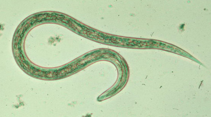 Candida albicans: une mycète pathogenique digestive et gynécologique. C.