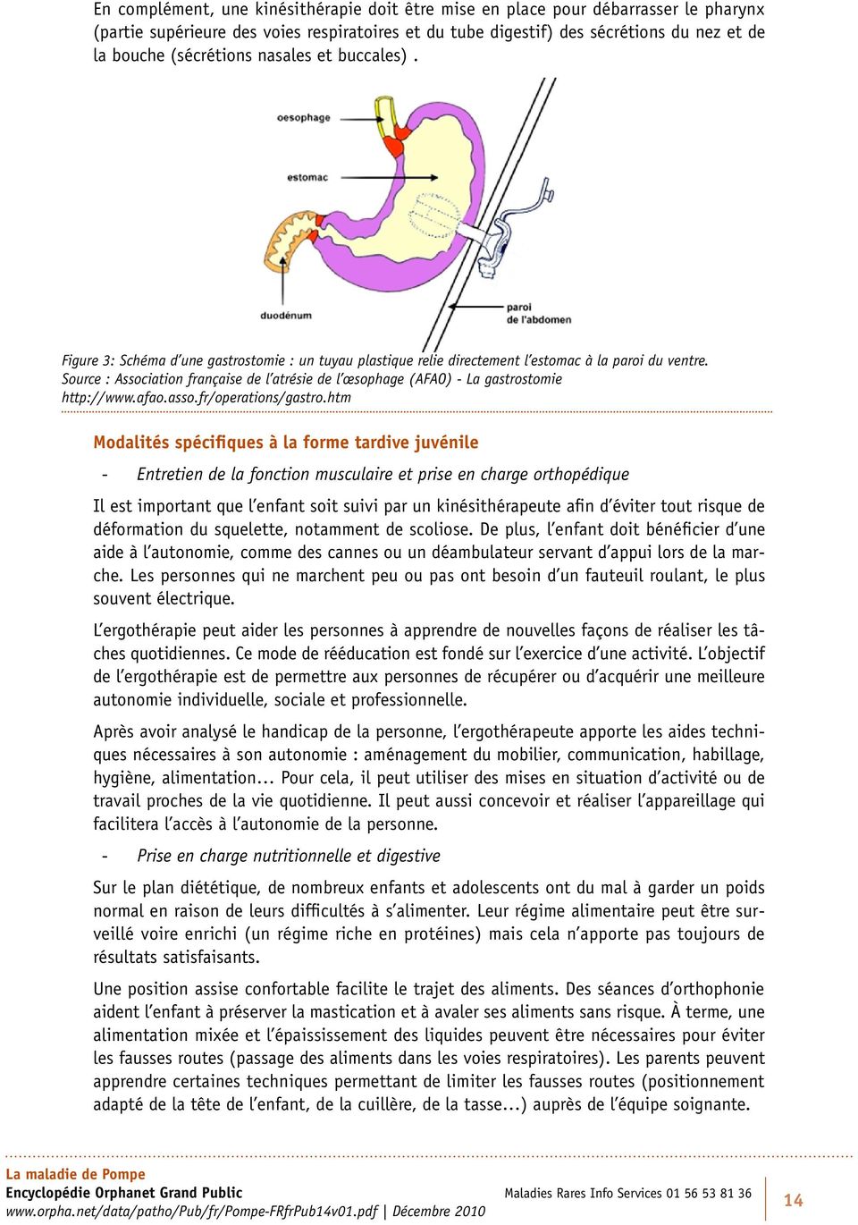 Source : Association française de l atrésie de l œsophage (AFAO) La gastrostomie http://www.afao.asso.fr/operations/gastro.