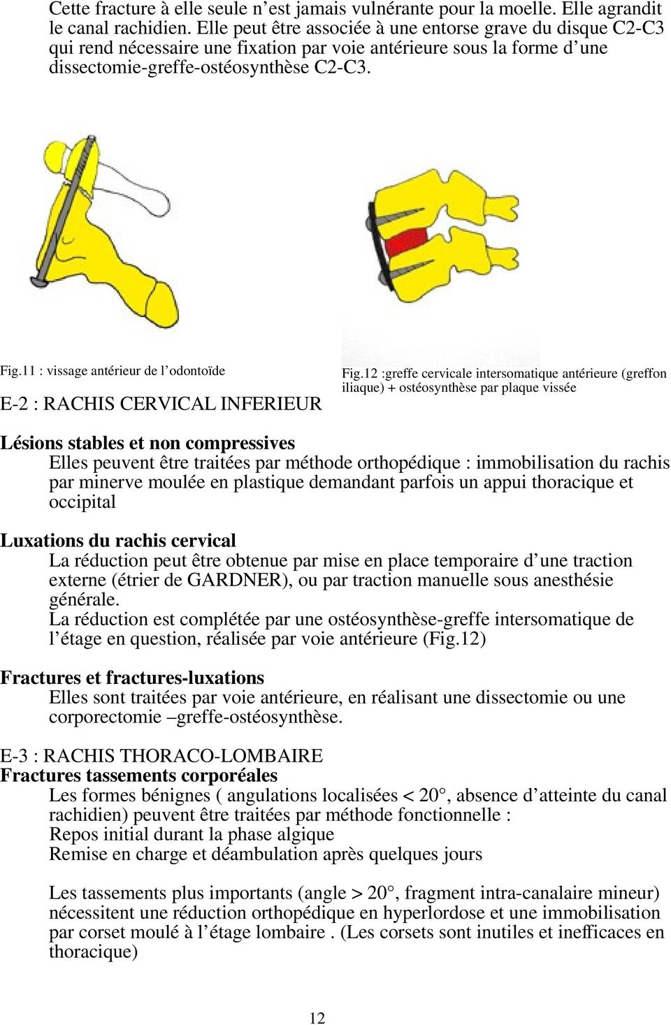 11 : vissage antérieur de l odontoïde E-2 : RACHIS CERVICAL INFERIEUR Fig.