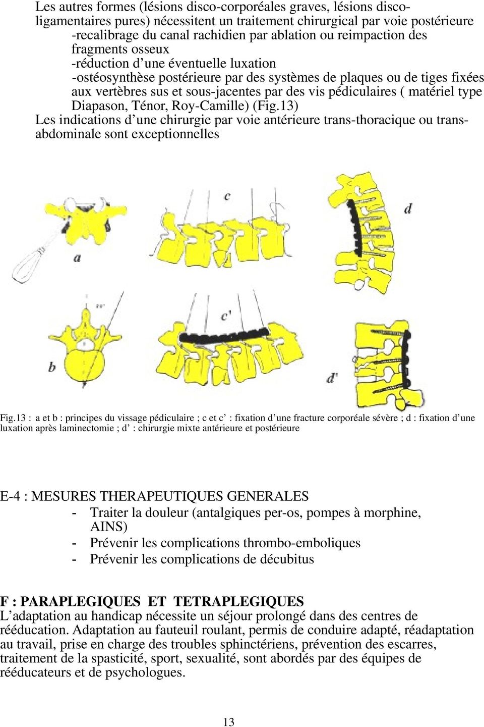 pédiculaires ( matériel type Diapason, Ténor, Roy-Camille) (Fig.13) Les indications d une chirurgie par voie antérieure trans-thoracique ou transabdominale sont exceptionnelles Fig.
