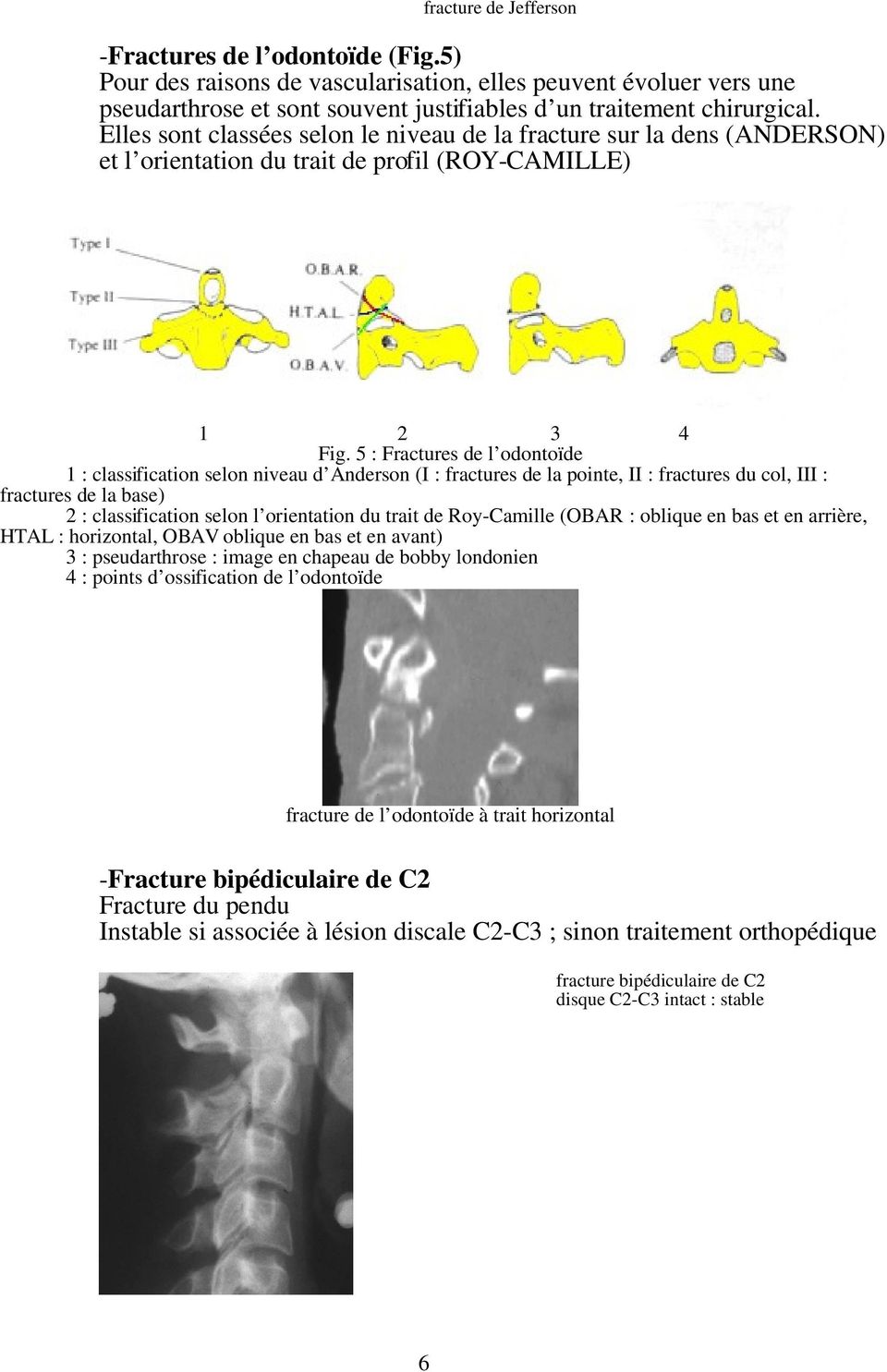 5 : Fractures de l odontoïde 1 : classification selon niveau d Anderson (I : fractures de la pointe, II : fractures du col, III : fractures de la base) 2 : classification selon l orientation du trait