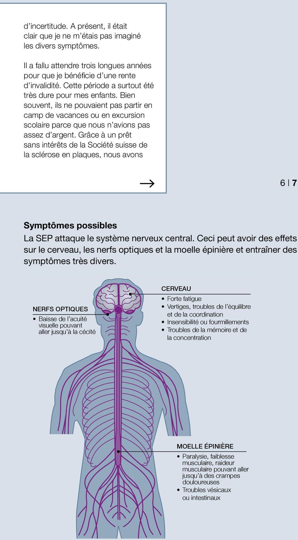 Grâce à un prêt sans intérêts de la Société suisse de la sclérose en plaques, nous avons A 6 B7 Symptômes possibles La SEP attaque le système nerveux central.