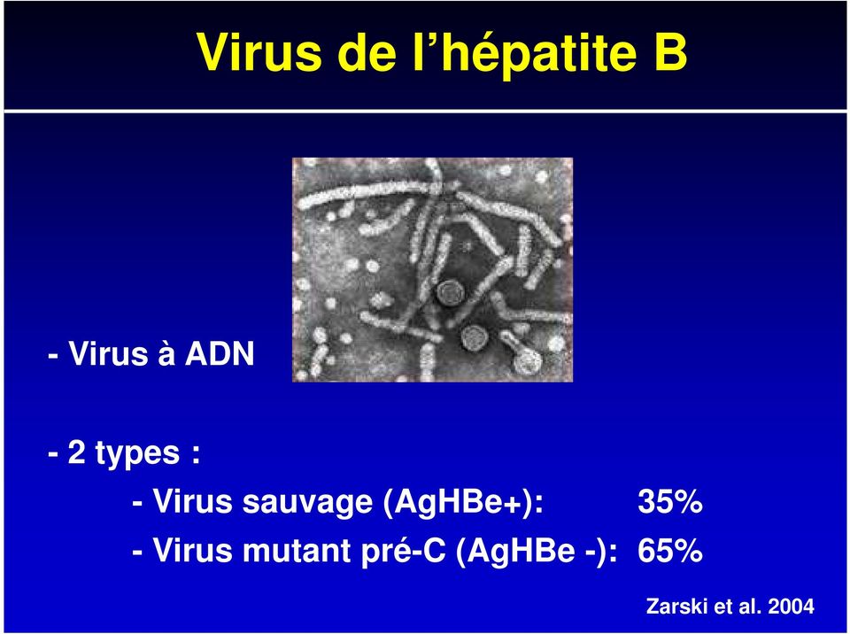 (AgHBe+): 35% - Virus mutant