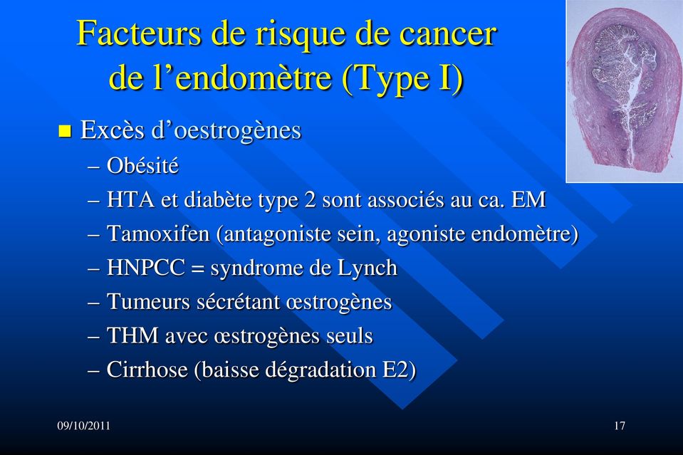 EM Tamoxifen (antagoniste sein, agoniste endomètre) HNPCC = syndrome de