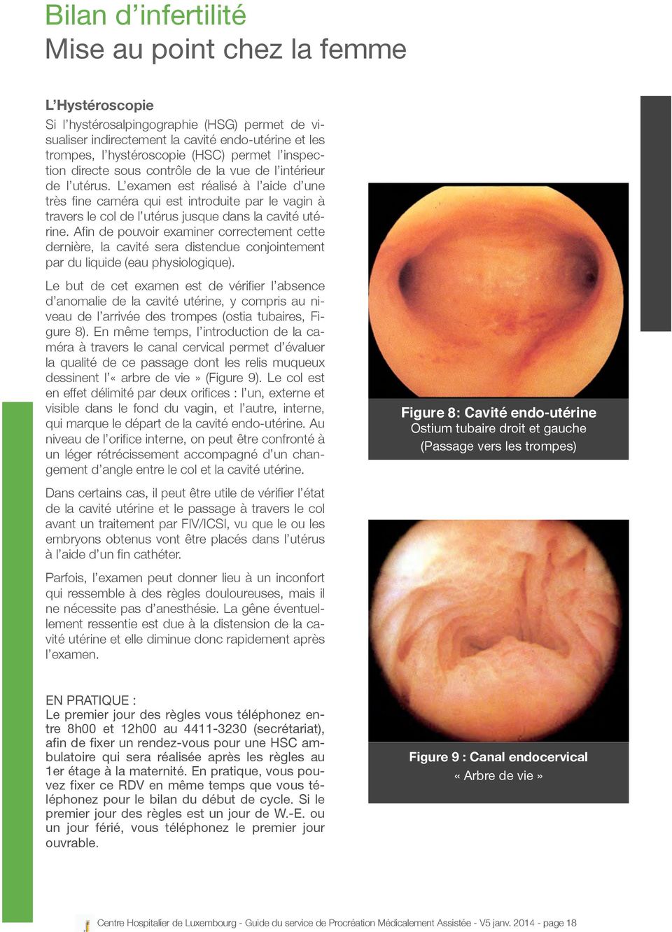 L examen est réalisé à l aide d une très fine caméra qui est introduite par le vagin à travers le col de l utérus jusque dans la cavité utérine.