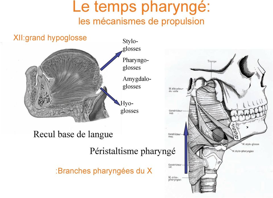 Pharyngoglosses Amygdaloglosses Recul base de