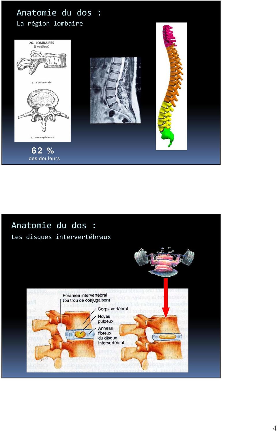douleurs Anatomie du dos