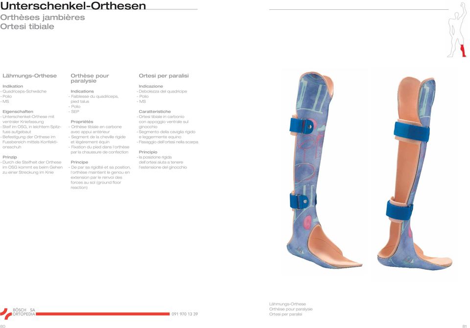 quadriceps, pied talus - Polio - SEP - Orthèse tibiale en carbone avec appui antérieur - Segment de la cheville rigide et légèrement équin - Fixation du pied dans l'orthèse par la chaussure de
