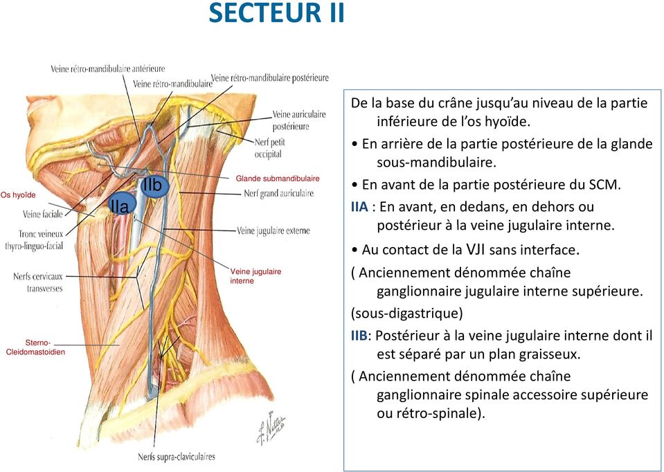 IIA : En avant, en dedans, en dehors ou postérieur à la veine jugulaire interne. Au contact de la VJI sans interface.
