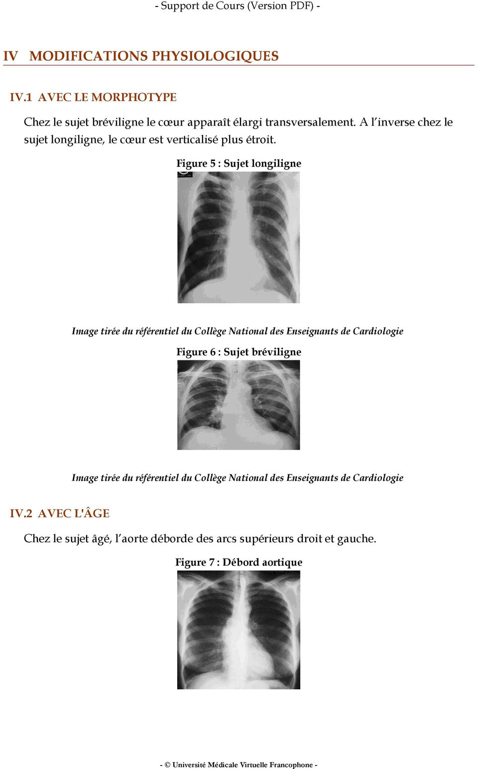 Figure 5 : Sujet longiligne Image tirée du référentiel du Collège National des Enseignants de Cardiologie Figure 6 : Sujet