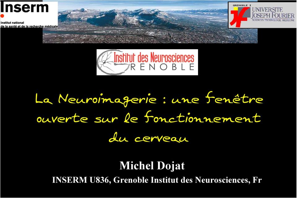 cerveau Michel Dojat INSERM U836,
