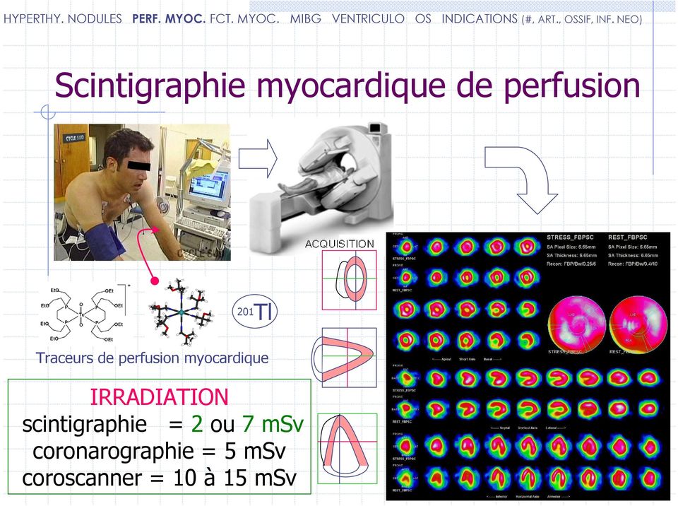 IRRADIATION scintigraphie = 2 ou 7 msv