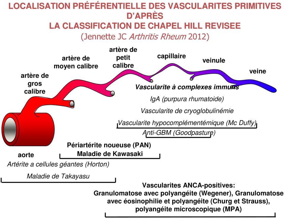 Vascularite à complexes immuns IgA (purpura rhumatoide) Vascularite de cryoglobulinémie Vascularite hypocomplémentémique (Mc Duffy) Anti-GBM (Goodpasture) veine Maladie