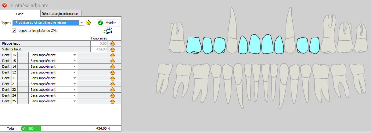Les prothèses adjointes définitives à plaque base résine Après localisation des dents Les