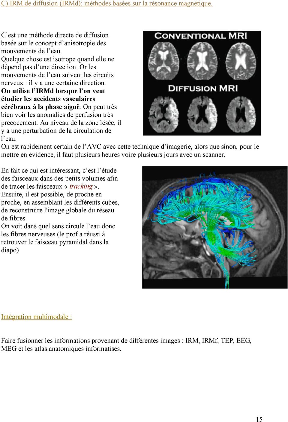 On utilise l IRMd lorsque l on veut étudier les accidents vasculaires cérébraux à la phase aiguë. On peut très bien voir les anomalies de perfusion très précocement.