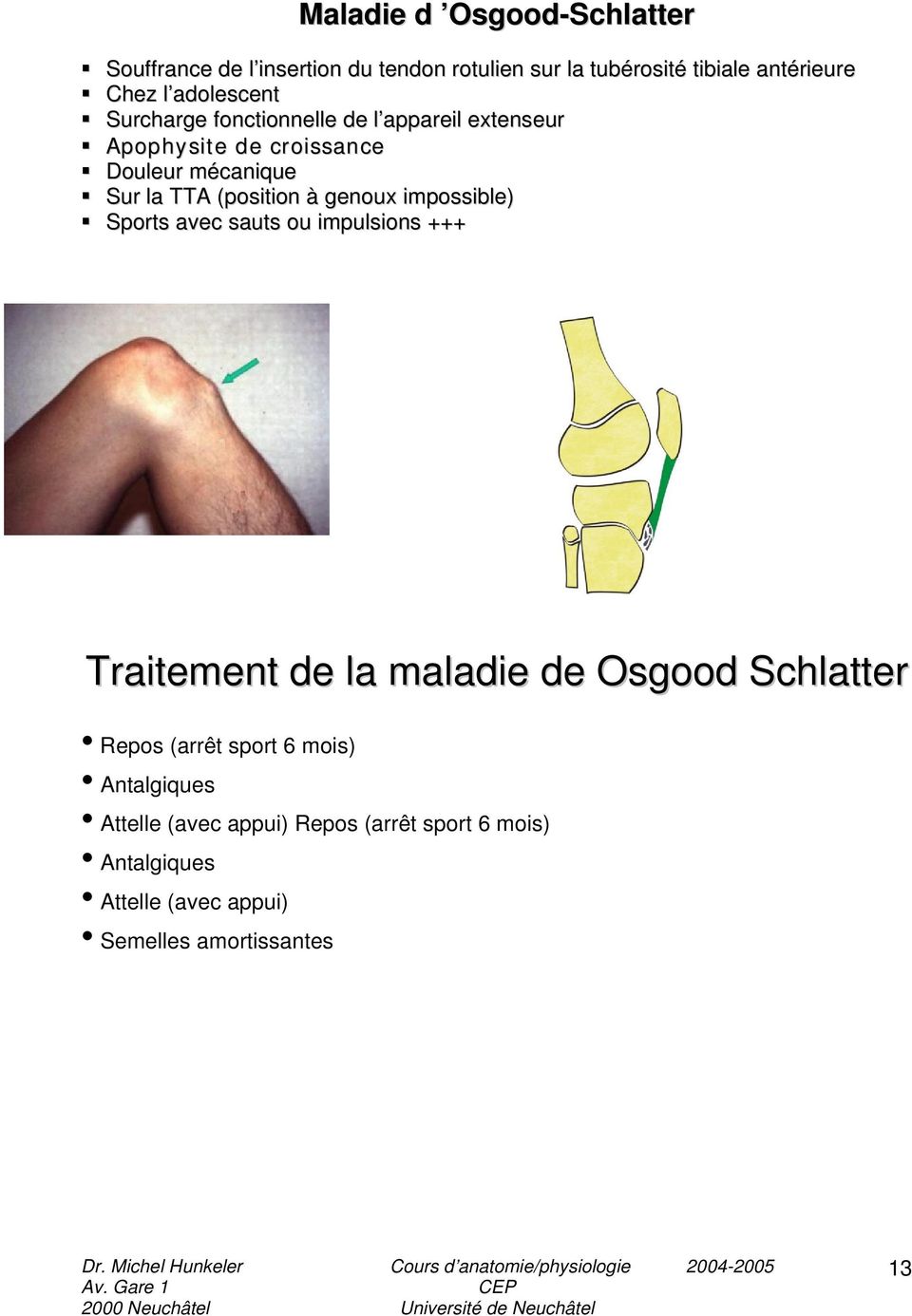 (position à genoux impossible) Sports avec sauts ou impulsions +++ Traitement de la maladie de Osgood Schlatter Repos