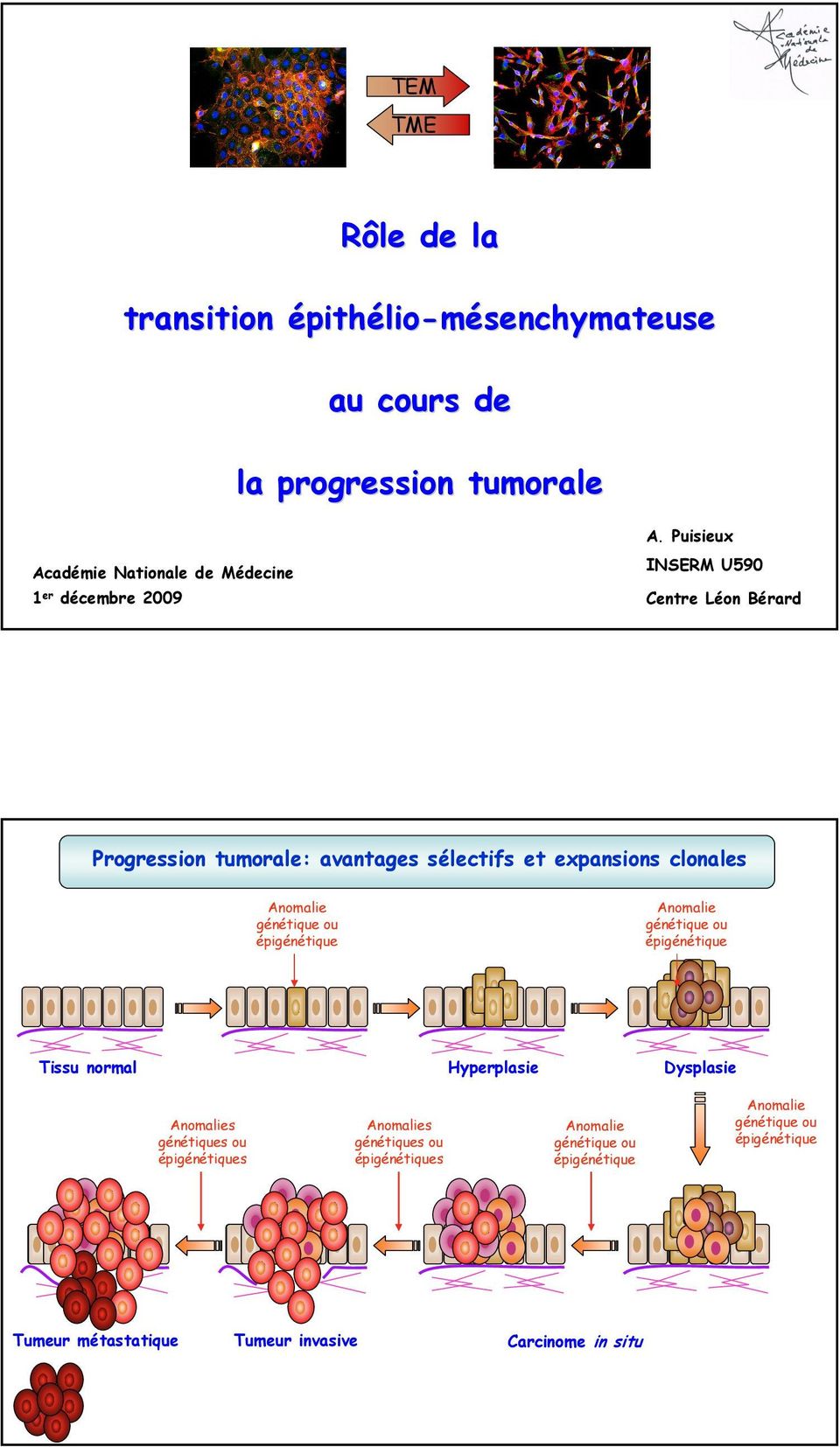 Puisieux INSERM U590 Centre Léon Bérard Progression tumorale: avantages sélectifs et