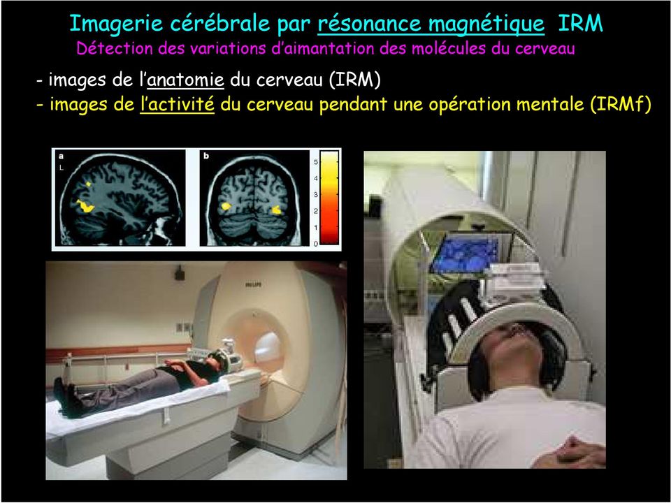 cerveau - images de l anatomie du cerveau (IRM) -