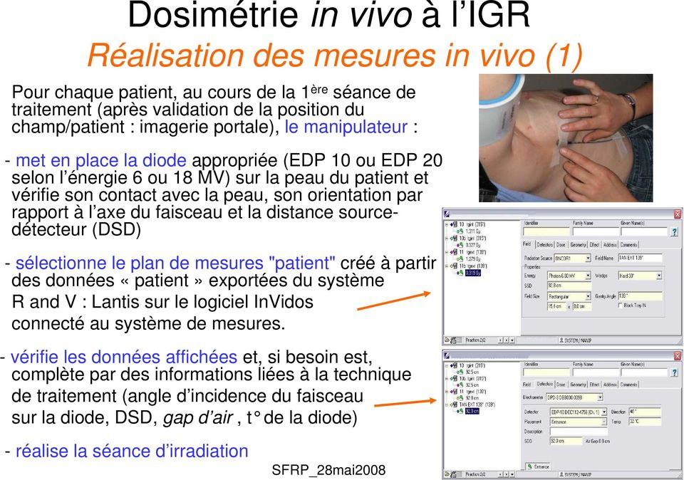 sourcedétecteur (DSD) - sélectionne le plan de mesures "patient" créé à partir des données «patient» exportées du système R and V : Lantis sur le logiciel InVidos connecté au système de mesures.