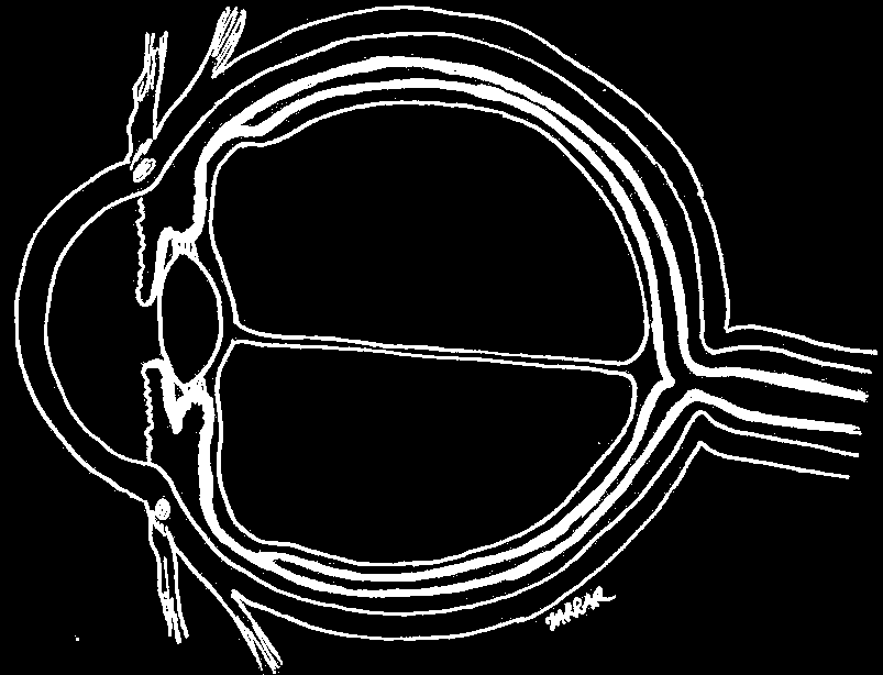 I. GLOBE OCULAIRE : Avant Corps ciliaire Iris Cristallin Sclère Choroïde Rétine Corps vitré Canal hyaloïde Humeur aqueuse Cornée Pupille N.