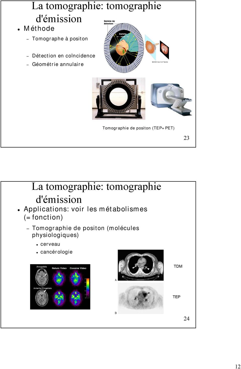 tomographie: tomographie d'émission Applications: voir les métabolismes