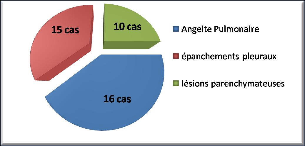 Manifestations pleuro pulmonaires et Maladie de Behçet (Est Algérien - 1990 2013) Manifestations cliniques % Aphtose buccale 100% Aphtose génitale 91,89% Pseudo folliculite 63,51% Articulaires 57,83%