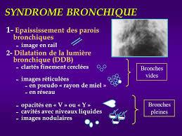 2. Syndrome bronchique Définition : Il peut être défini comme l ensemble des manifestations radiologiques des affections bronchiques qui ont pour caractéristiques communes d entrainer une