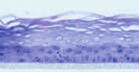 Diminution de la formation de la couche cornée Aroleat Samphira 1% Après 6 jours de traitement avec Aroleat Samphira à 1%, le marquage coloré (marron) attestant de la localisation de la filaggrine