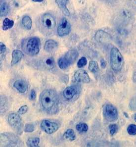 plasmocytes