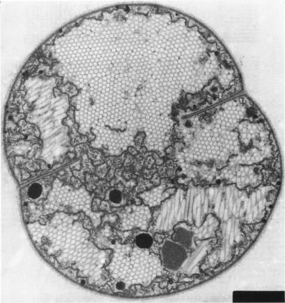 Inclusions Vésicules de gaz (hexagonales) chez la cyanobactérie Microscystis sp. Cellule en cours de division. Observation en microscopie électronique.