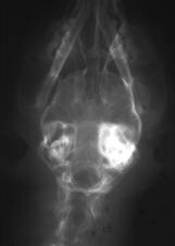 (culture/antibiogramme) Otite externe: F) IMAGERIE DES BULLES TYMPANIQUES Si soupçon on d otite moyenne Radiographie, scan ou résonnance changement radiographique observés s dans ~ 75% % des cas d