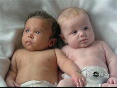 Vidéo: ABC News- All in the family: Mixed race twins http://abcnews.go.