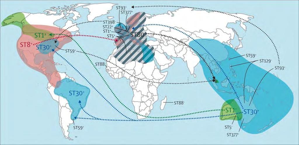 Migrations des SARM-co à CA-MRSA & MIGRATION travers le monde