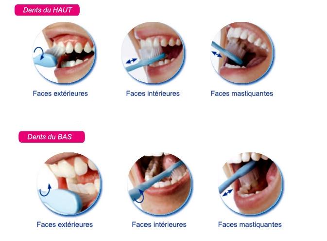 Hygiène & guide de brossage Guide de brossage : Brosse à dent électrique ou manuelle?