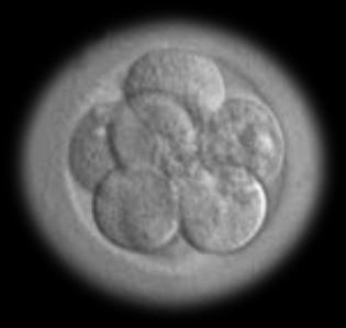 2 grades -2 grades 3-4 Qualité embryonnaire * Grades -2: 6-8 cellules