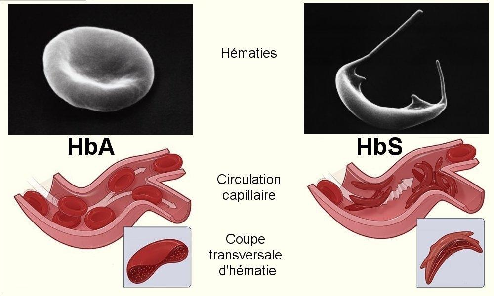 Relation entre structure et fonctionnalité des protéines Hématies en forme de faucille d'un individu possédant de l'hémoglobine de type S ces individus présentent des déficiences
