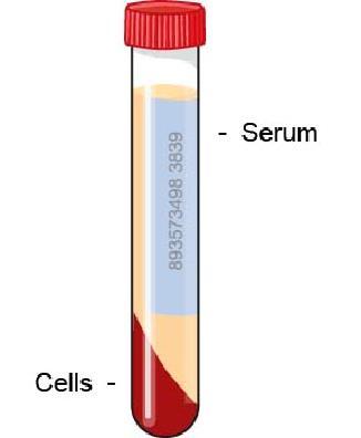 Les protéines du sérum peuvent être séparées par migration dans un champ électrique Les protéines peuvent être identifiées par la fixation de
