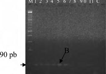 82 D. Traoré et al. Table 2. Observed, expected and total heterozgosity at the locus α S1 casein (exon 19) in Guéra and Sahel goat Heterozygoty observed (H o ) expected (H e ) Guéra goat: 0.