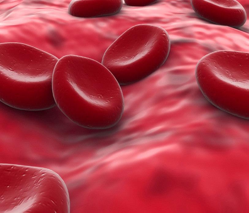 Dans la drépanocytose, le globule rouge anormal (SS), dans certaines conditions,