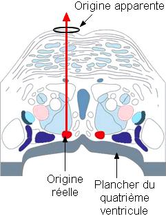Trijumeau (3 branches pour la sensibilité de la face, et une toute petite branche motrice pour la mastication) : c est le grand nerf sensitif de la face.