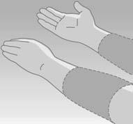 Prélèvement à partir d un autre site de test Les prélèvements pratiqués sur l avantbras ou la paume de la main permettent d éviter des prélèvements trop fréquents sur le bout du doigt.