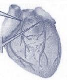 Médicaments cardiotoniques 1/ Les glucosides cardiotoniques (Digitaliques): Propriétés pharmacologiques: Cardiaques - Inotrope + : augmentation de la contractilité cardiaque.