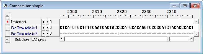 D'après La reproduction chez les mammifères et l'homme, Thibault - Levasseur, p244, fig 12-02 modifiée, Ellipses 2001 Document 2 : données cliniques et génétiques d'une personne de caryotype 2n = 46,