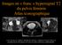 Images en «franc» hypersignal T2 du pelvis féminin Atlas iconographique