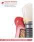 Implants dentaires. Informations sur la maintenance implantaire à destination des professionnels dentaires GUIDE DESTINÉ AUX PROFESSIONNELS DENTAIRES