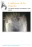 Hanche. Des signes cliniques au traitement - Fiche patient. Dr Maxime-Louis Mencière - 26 juin 2015 ARTHROSE DE LA HANCHE - DR MAXIME-LOUIS MENCIÈRE 1